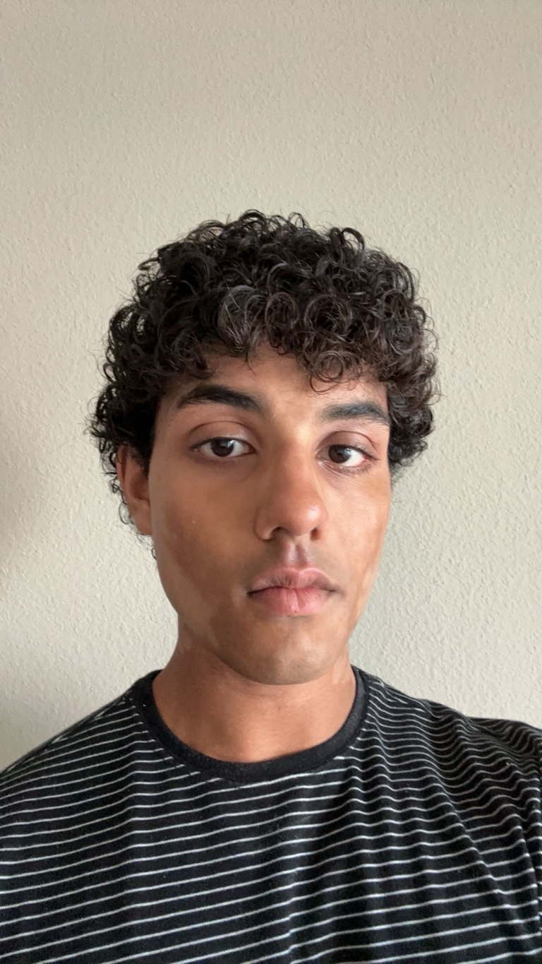 A person with short curly hair and a neutral expression is wearing a black and white striped shirt, standing in front of a plain light-colored wall.
