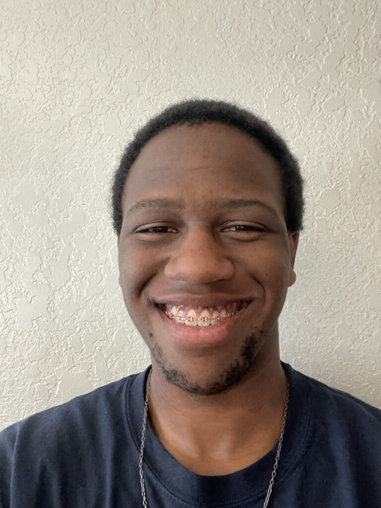 A person with short hair and braces smiles at the camera, wearing a dark shirt and a necklace, standing in front of a textured light-colored wall.